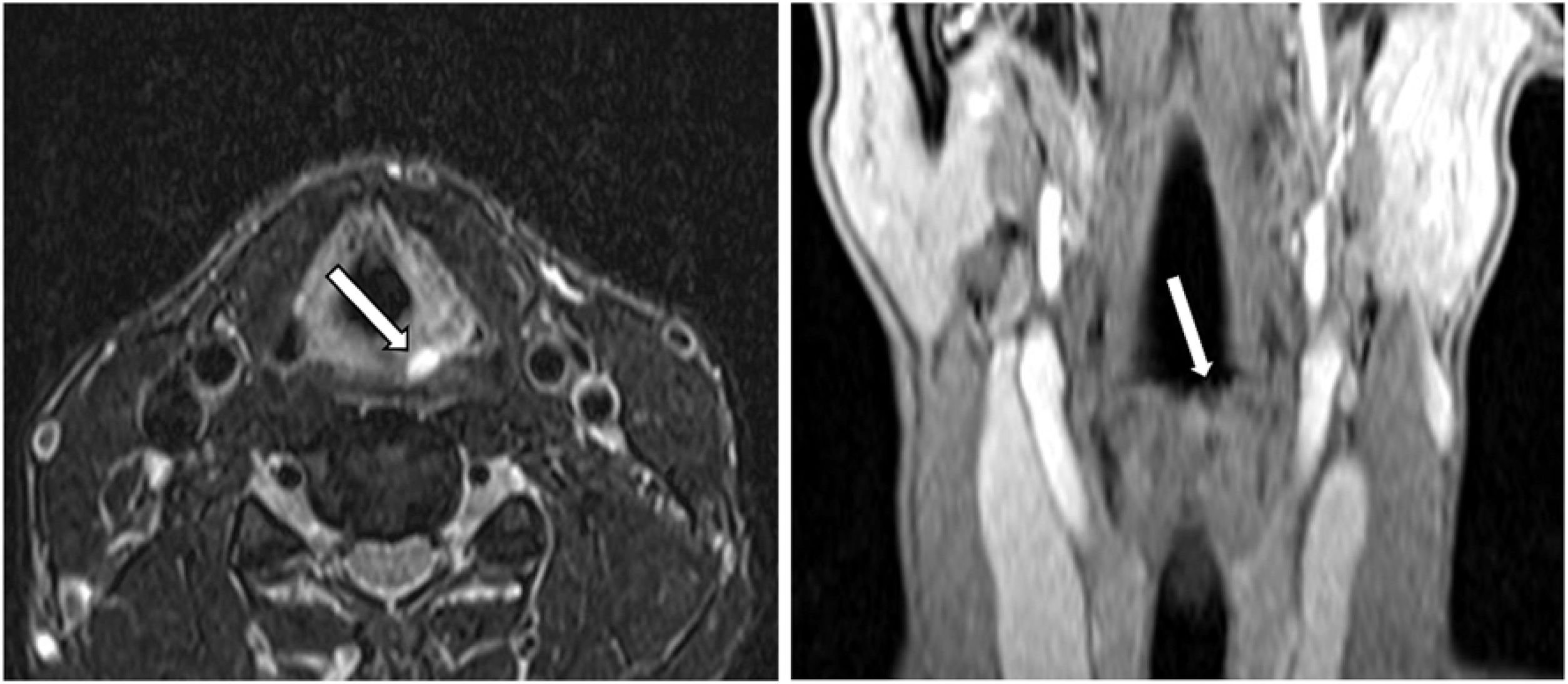 fig0015