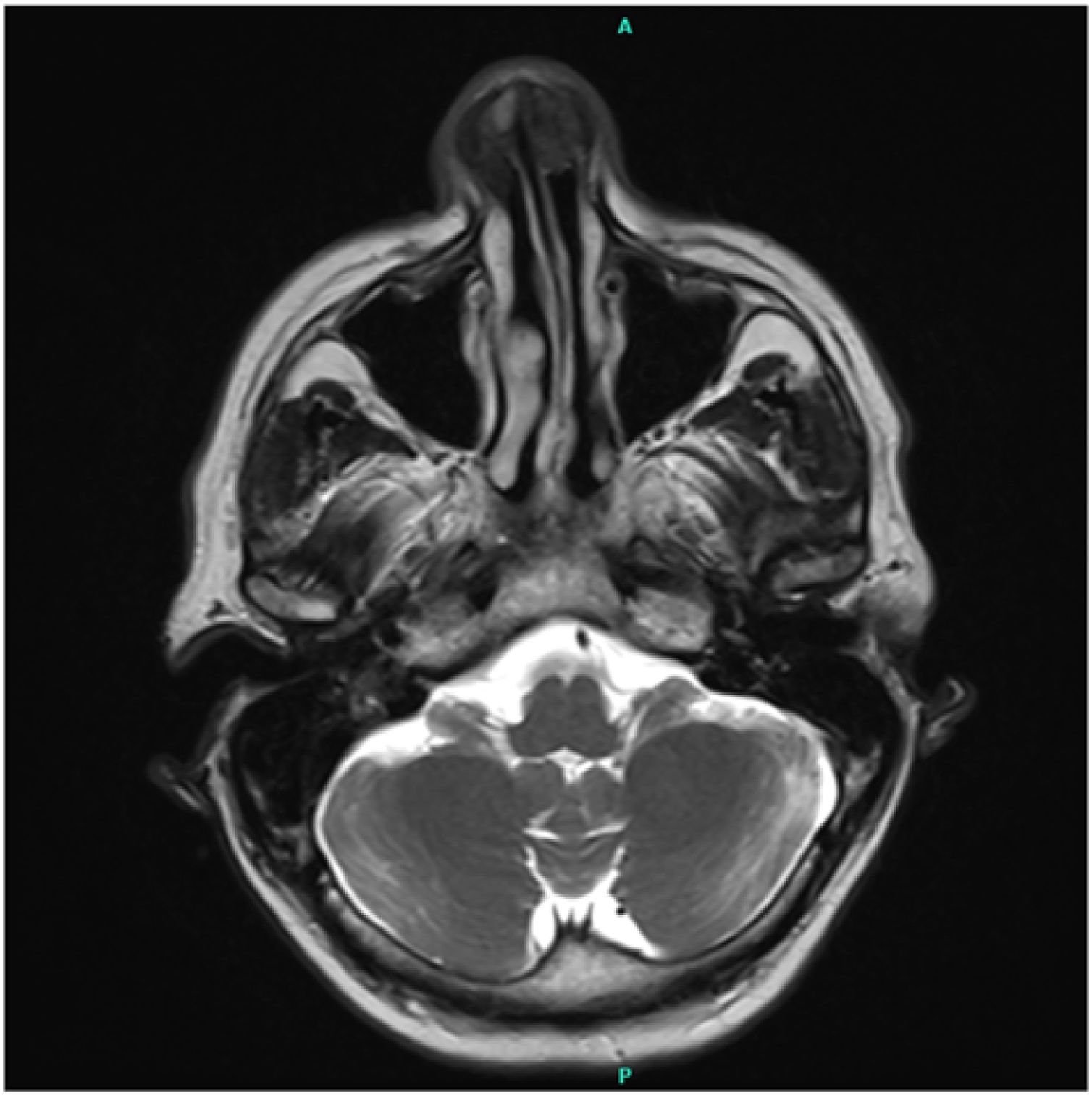 fig0005