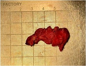 The specimen measured approximately 4 × 2 cm.