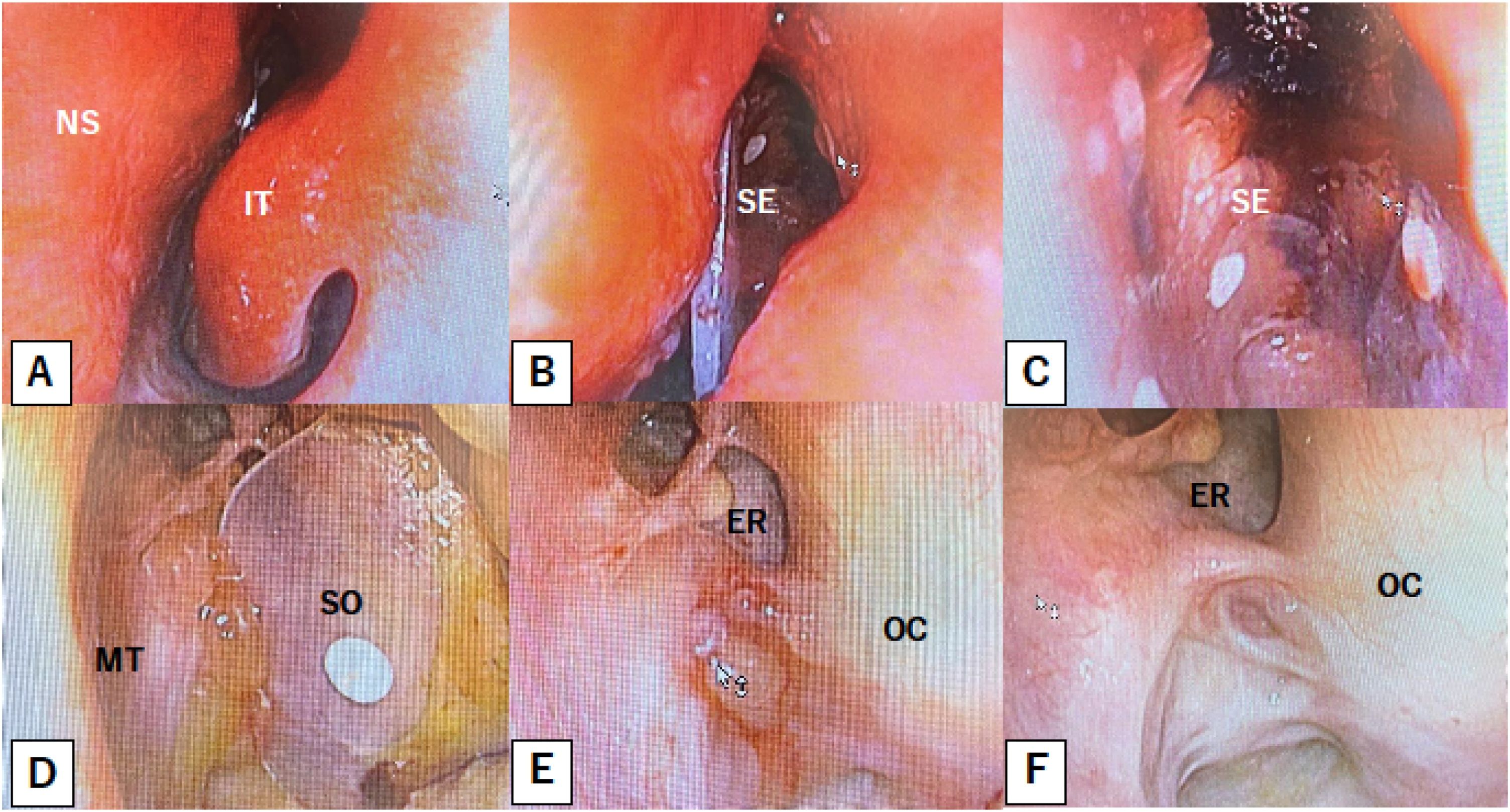 fig0015