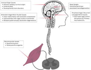 Neuroanatomical localization of neurological causes of paradoxical vocal fold motion.