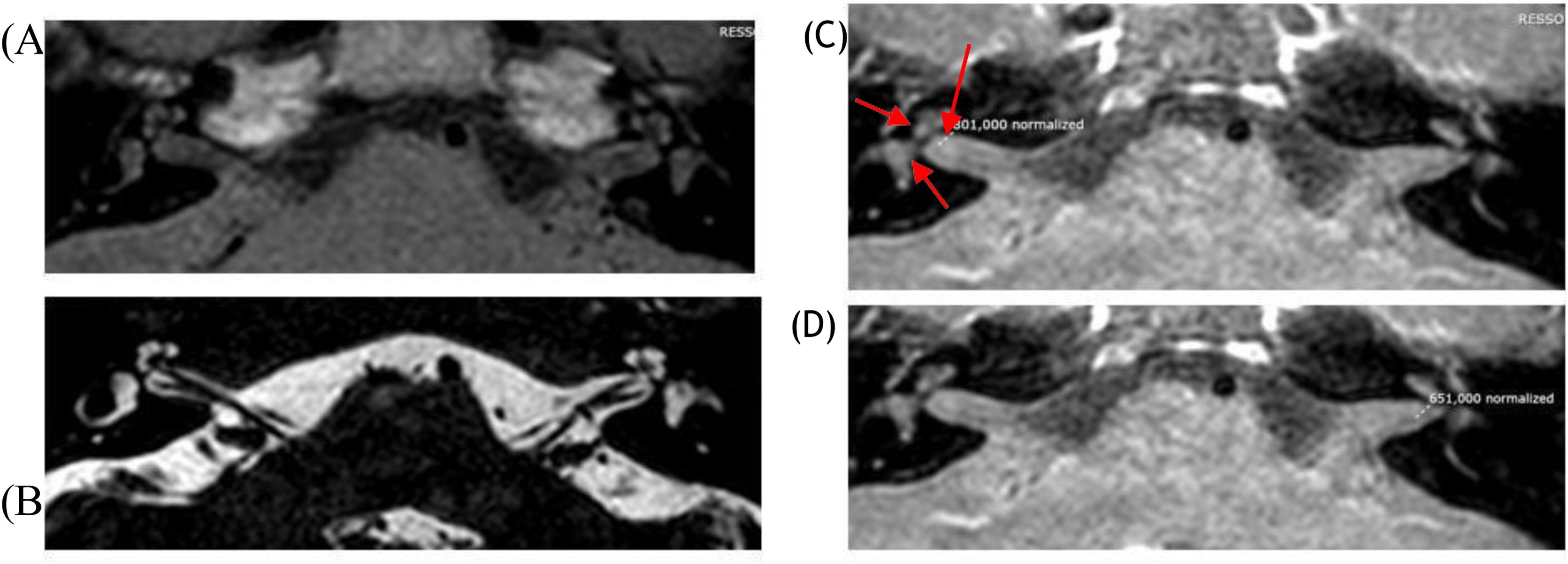 fig0005