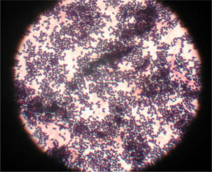 – Imagen obtenida del hemocultivo de la paciente del caso 2, que muestra Listeria monocytogenes.