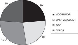 Pacientes del grupo 2 con epilepsia extratemporal: hallazgos en las IRM. ECV: enfermedad cerebro-vascular; Malf. vascular: malformación vascular; MDC: malformaciones del desarrollo cortical.