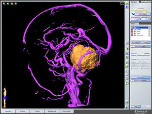 Igual imagen a la anterior en la que se ha sustraído el polígono de Willis.