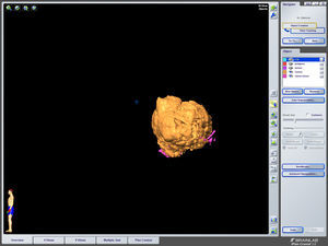Muestra únicamente la masa tumoral.
