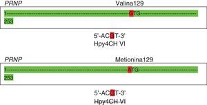 Caracterización del codón polimórfico 129 del gen RNP (metionina/valina) del gen PrnP mediante una enzima de restricción (RFLP). MV en codón 129 del gen del prion humano. Polimorfismo M/V 129 del gen PRNP.ATG: metionina; GTG: valina.