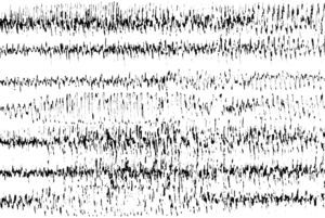 EEG al ingreso durante el estatus tónico-clónico: ritmo reclutante rápido con paroxismos generalizados de polipunta-onda persistentes en todo el registro.