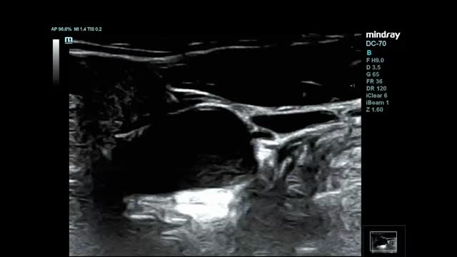 https://ars.els-cdn.com/content/image/1-s2.0-S1853002823000447-mmc1.mp4