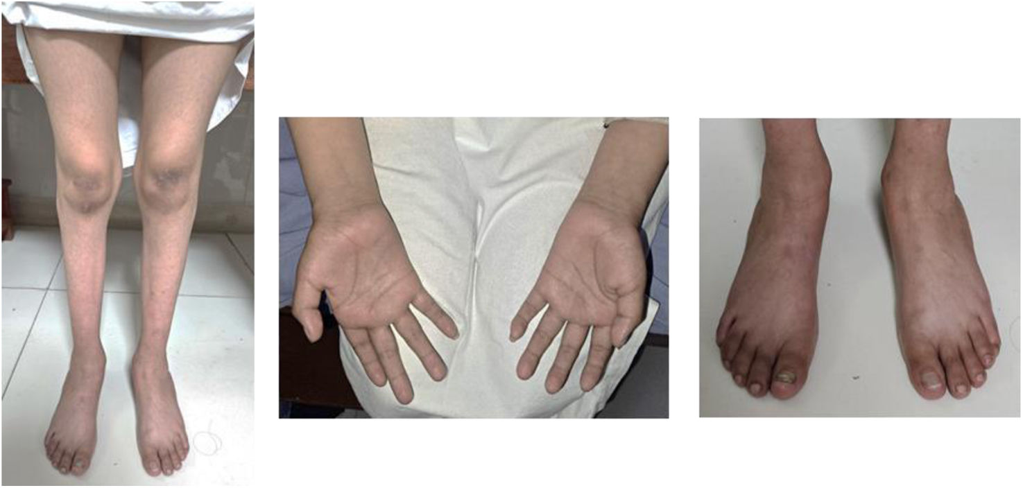 fig0005