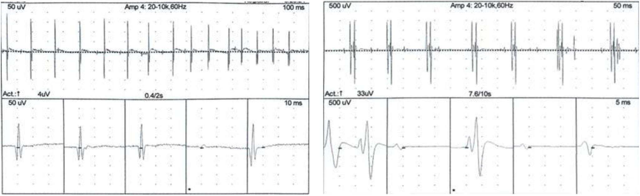 fig0010
