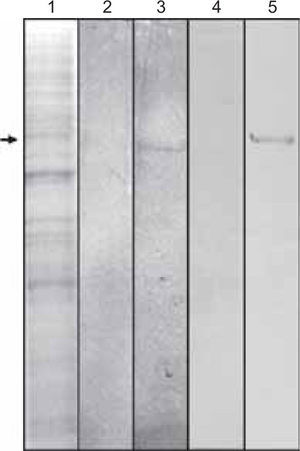 Se observa en la línea 1 la tinción con Coomassie azul de las proteínas expresadas por las células de Drosophila melanogaster y transfectadas con el gen de la proteína del cemento. La flecha indica la especie de 50 kDa. La línea 2 representa el control negativo de células que no expresan constitutivamente el gen de la proteína del cemento. La línea 3 nos muestra el reconocimiento de una banda de 50 kDa por medio del anticuerpo anti-6Xhis. La línea 4 representa el control negativo utilizando el anticuerpo recombinante contra la proteína del cemento. La línea cinco muestra una banda de 50 kDa reconocida por el anticuerpo antiproteína del cemento.