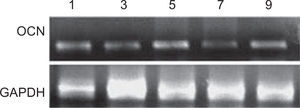 Expresión de gen que codifica para la osteocalcina a diferentes días de tratamiento ortodóncicos. Control interno gen que codifica para la GAPDH.