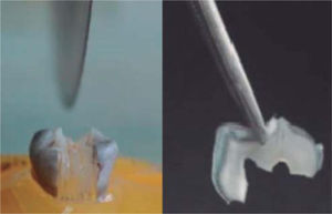 Corte longitudinal de 150 a 250 µm de un diente expuesto al xilitol por un periodo de 15 días.