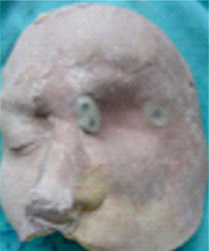 Placa base de resina con los imanes en el modelo de trabajo.