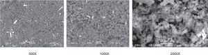 Micrografías electrónicas de Barrido con magnificaciones de 500X, 1000X y 2000X de MTA Angelus donde se observa una estructura porosa e irregular, se identifica Bismuto el cual se observa como gránulos sueltos.