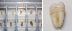 El panel izquierdo muestra el almacenamiento de los especímenes y en el panel derecho se muestra el marcaje hecho en la preparación de un espécimen para la aplicación del gel