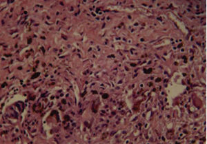 Cemento Bioceramic (10 días), se observan escasos fibroblastos. Infiltrado inflamatorio moderado (H&E) (40X).