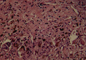 Bioceramic cement (10 days) revealing scarce fibroblasts. Moderate inflammatory infiltrate (H&E) (40x).