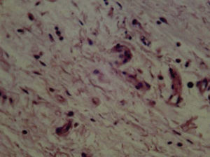 Bioceramic cement (21 days) with fibroblasts and collagen presence. Mild inflammatory infiltrate (H&E) (40X).
