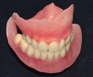 Trimmed and polished dentures.