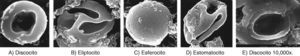 Alteraciones morfológicas de eritrocitos expuestos a NaOCl 5.25% de uso odontológico, mediante imágenes obtenidas por microscopia electrónica de barrido de alta resolución. A) Discocito: disco bicóncavo sin núcleo. B) Eliptocito: forma elíptica con extremidades redondeadas y paredes laterales poco abombadas. C) Esferocito: eritrocito esférico con denso contenido de hemoglobina sin claro o halo central. D) Estomatocito: eritrocito con una zona central elongada en forma de boca. E) Discocito a 10,000x en donde se observa daño estructural a nivel de la membrana plasmática.