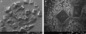A) Presencia de cristales de NaOCl con diferentes estructuras geométricas distribuidos en la muestra. B) Cristales de NaOCl en contacto con eritrocitos a magnitud de 500x.