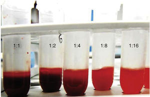 Red blood cell dilutions with PBA.