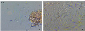 A) Imagen a las 72 horas de cultivo se observa el crecimiento de células alrededor del explanto. B) Imagen tomada a los ocho días de cultivo en confluencia.