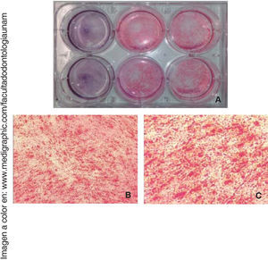 Tinción con rojo de alizarina. A) Fotografía macroscópica en contraste con hematoxilina de las células control e inducidas a diferenciación a 14 días. Tinción con rojo de alizarina de las células diferenciadas B) 10x y C) 40x.