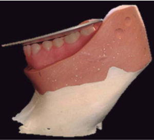 Colocación de dientes inferiores utilizando la platina curva.