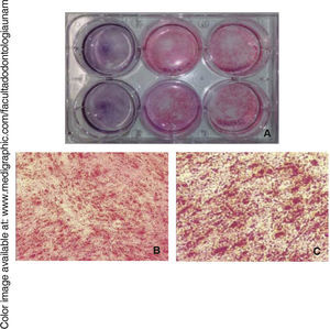Staining with alizarin red A) macroscopic photograph with contrast with hematoxylin of control cells and cells induced to differentiation after 14 days. Staining with alizarin red of differentiated cells B) 10x, C) 40x.