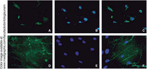 Images taken with fluorescence microscope. A) Expression of RUNX2, 40x (green), B) Nuclear DAPI (blue) 40x and C) Fusion 40x, D) Osteocalcin (green), E) Nuclear DAPI (blue) 63x and F) Fusion 63x.