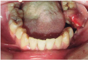 Intraoral photograph.