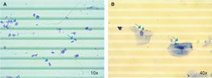 Células epiteliales en saliva. Cuantificación celular en suspensión de trypan blue. A) y B) Identificación de células epiteliales en muestras de saliva (flechas) utilizando microscopio óptico con objetivos de 10x y 40x respectivamente.
