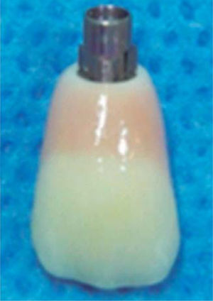 Pilar con cerámica rosada.