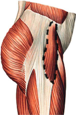 Músculo tensor de la fascia lata.12