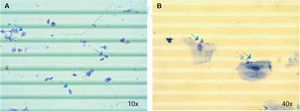 Epithelial cells in saliva. Cell quantification in trypan blue solution. A) and B) Epithelial cell identification in saliva specimens (arrows) using optic microscope with 10x and 40x lenses respectively.