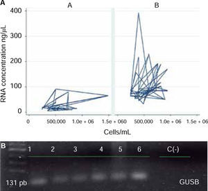 Protocol characteristics and genic expression of gene GUSB. A) Modular behavior of protocols according to their operative characteristics. Protocol A (QIAzol®) and B (RNeasy® Protect Saliva Mini Kit-Qiagen). B) Agarose gel at 1% from PCR amplification of gene GUSB.