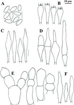 Boletus paulae: A, basidiosporas; B, basidios; C, pleurocistidios, D, elementos del stipitipellis, E, elementos del pileipellis; F, queilocistidios.