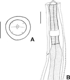 Physaloptera sp. third stage larva. A, anterior end, apical view, 3 small internolateral teeth on each lip; B, anterior end.