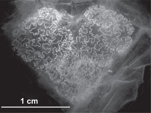 Heart-shaped dorsal tubercle of the solitary zooid of Helicosalpa komaii from off Baja California.