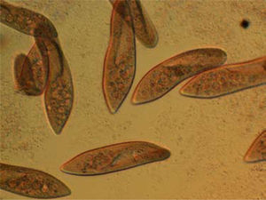 Paramecium sp. del lago de Xochimilco, D. F. Varios individuos de este ciliado con numerosas vacuolas y la citofaringe.