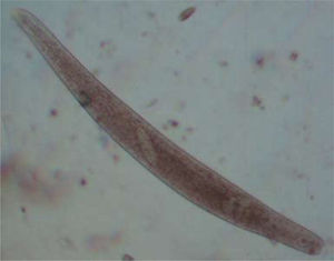 Spirostomum sp. del lago de Xochimilco, D. F. En la imagen se observa un individuo donde destacan las cinetias, algunas vacuolas digestivas así como el macronúcleo.