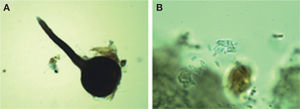 Ophiostoma pulvinisporum. A, peritecio (10×); B, ascosporas en forma de cojín o almohada (400×).