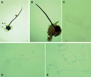 Ophiostoma pluriannulatum. A y B, peritecios (40×); C, ascosporas (400×); D y E, fase asexual Hyalodendron.