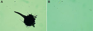 Ceratocystiopsis fasciata. A, ascocarpo; B, ascosporas falcadas.