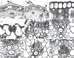 Detalles anatómicos de la lámina foliar de los géneros del complejo Milla, vistos en sección transversal. A) Bessera elegans (J. Gutiérrez y E. Bravo 1386) protuberancias epidérmicas (flecha); B) Milla biflora (J. Gutiérrez et al., 1162) protuberancias epidérmicas (flechas); C) B. elegans (J. Gutiérrez y E. Bravo 1386) paredes epidérmicas gruesas; D) Dandya balsensis (J. Gutiérrez 791) estomas con prolongaciones anteriores y posteriores; E), D. balsensis (J. Gutiérrez 791) rafidio (flecha); F) D. thadhowardii (J. Gutiérrez 798) haz vascular en forma de “v”; G) B. elegans (J. Gutiérrez y E. Bravo 1386) haz vascular en forma de “t”; H) D. hannibalii (J. Gutiérrez et al., 1241) floema con fibras en desarrollo; I) M. filifolia (J. Gutiérrez 1133) fibras de paredes gruesas sobre el floema. Escalas en A, B=100μm; F, G=50μm; C, E, H, I=20μm; D=10μm. e: epidermis; es: esponjoso; f: fibra; fl: floema; lpx: laguna del protoxilema; mx: metaxilema.