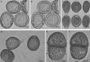 A-C) Uromyces crotalariae: A-B, uredosporas; A, vista mediana; B, vista superficial; C, teliosporas; arriba, vista mediana; abajo, vista superficial; D) Uromyces crotalariae-nitens: D, uredosporas vista mediana con poros germinativos (fecha); E-F) Uropyxis farlowii: E-F, teliosporas; E, vista mediana 2 poros germinativos por célula (fecha); F, vista superficial.