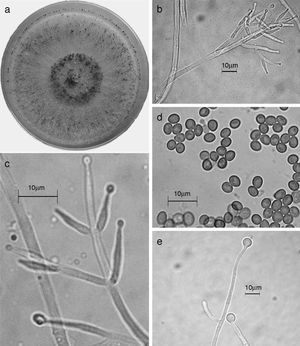 Trichoderma koningiopsis/H. koningiopsis. a) colonia en medio de cultivo PDA, después de 14 días a 25°C; b) conidióforo; c) fiálides; d) conidios; e) clamidospora. Descripción: Samuels et al. (2006); http://nt.arsgrin.gov/taxadescriptions/keys/TrichodermaIndex.cfm.